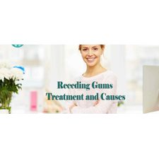 Receding Gums