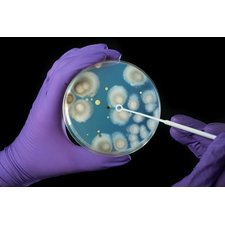 Pseudomonas aeruginosa symptoms & treatment