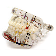 Dental Implant & Restoration Model 