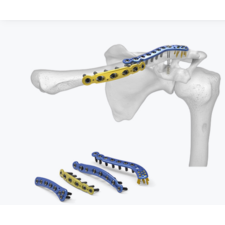 World's Top Orthopedic Implants Manufacturer India