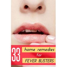 33 Amazing Home Remedies to Get Rid of Fever Blisters