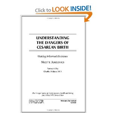 Amazon.com: Understanding the Dangers of Cesarean Birth: Making Informed Decisions (The Praeger Series on Contemporary Health and Living) (9780275999063): Nicette Jukelevics: Books