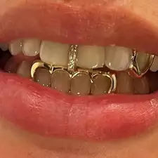 Single CZ Stone Vertical Bar Teeth Grillz 14K Gold Plated Cubic Zircon Tooth Caps