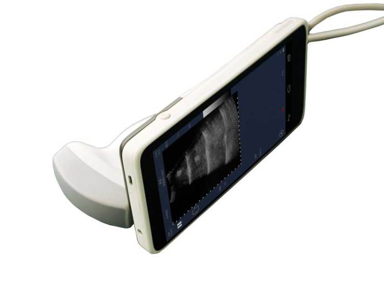 Wireless Color Ultrasound S...