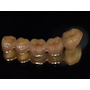 full contour zirconia_China...